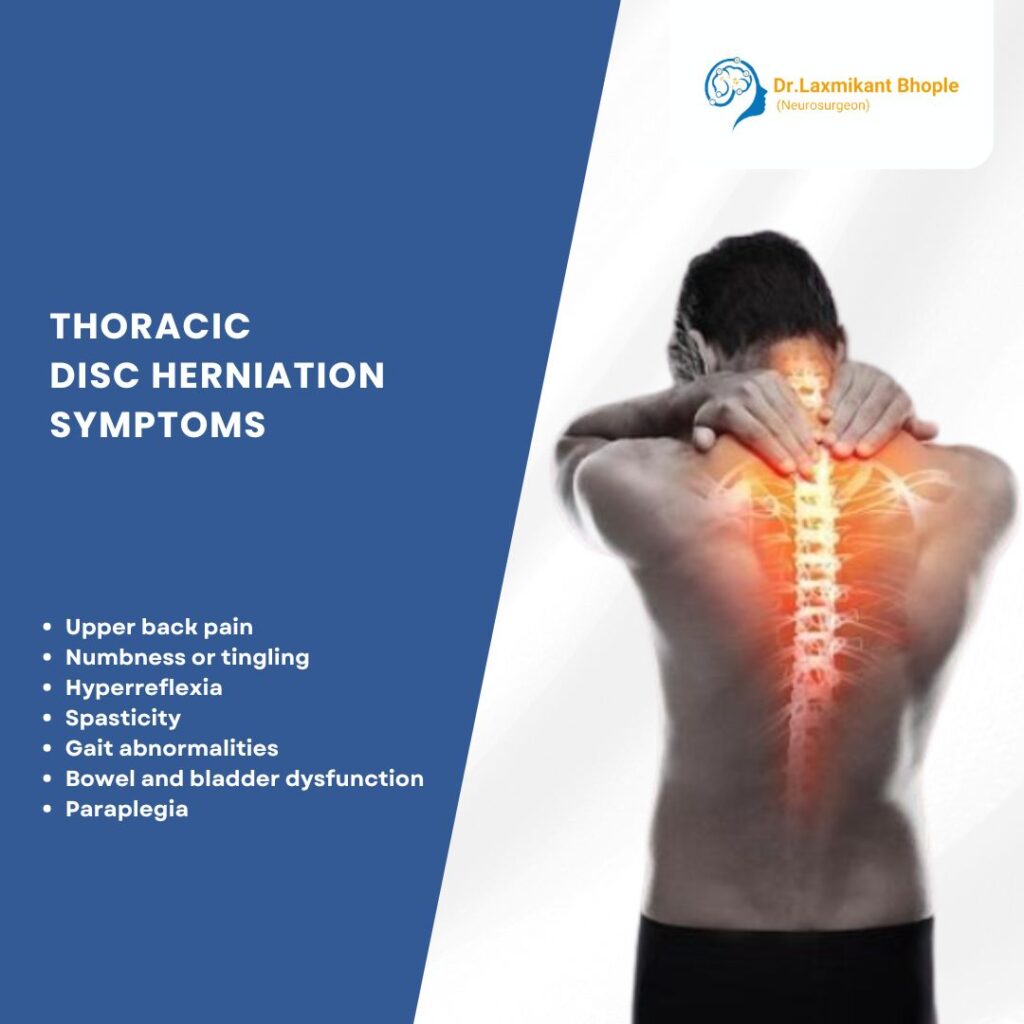 Thoracic Disc Herniation can cause pain, numbness, and mobility issues. Learn about symptoms, diagnosis, and treatment options.
